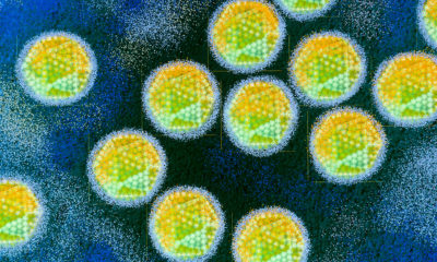 Mystery of global uptick in hepatitis affecting children may have been solved