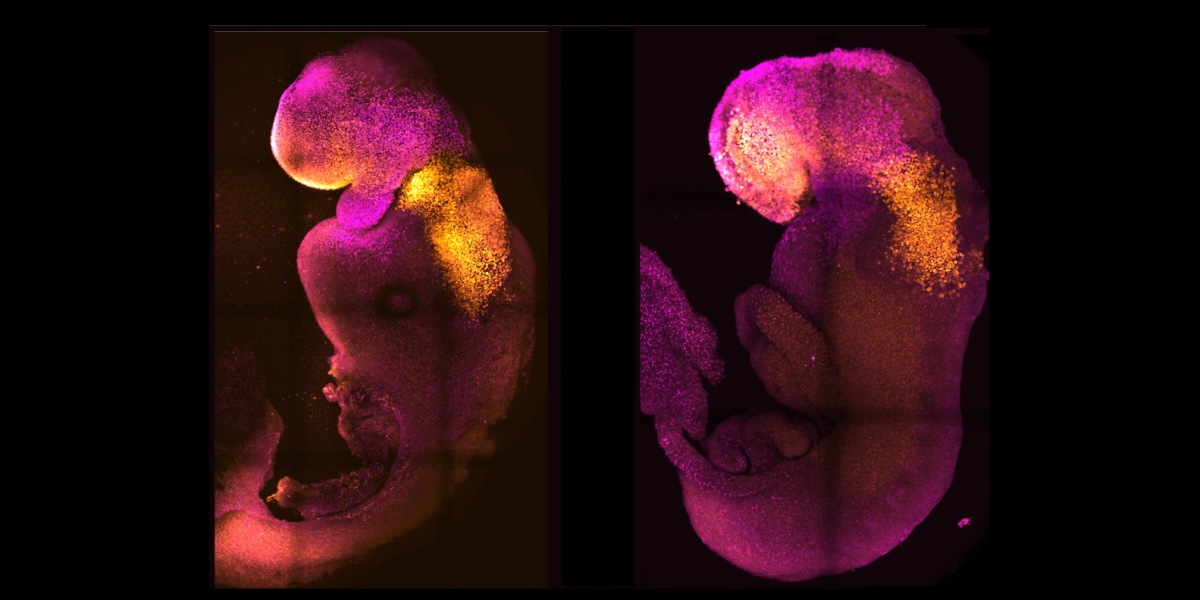 Scientists have created synthetic mouse embryos with developed brains