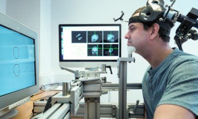 Brain stimulation might be more invasive than we think